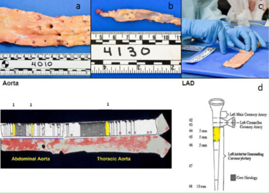 Figure 2: Selecting samples