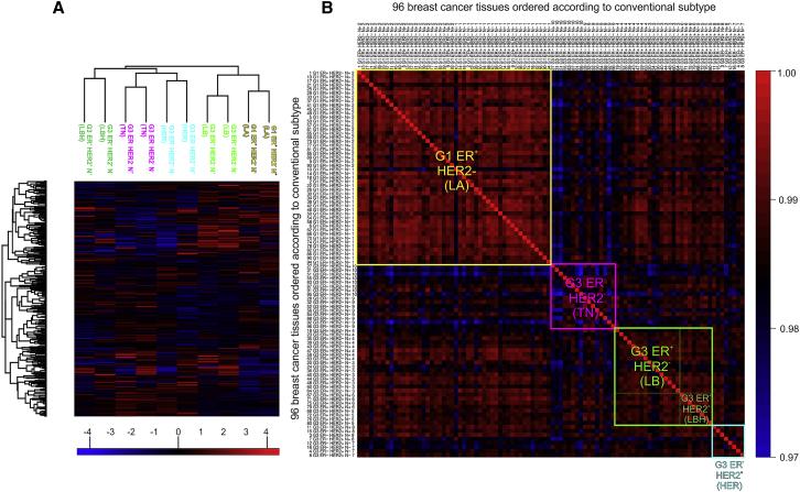 SWATH/DIA For Large-Scale Breast Cancer Subtyping