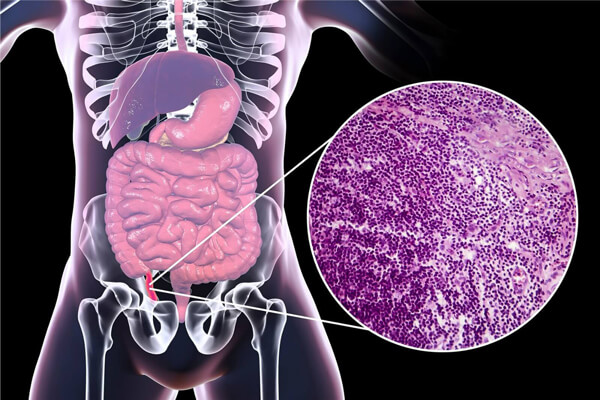 Metabolic Diseases