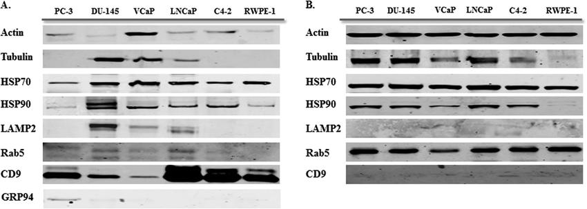 Western blot analysis for exosome markers in exosomes and corresponding cell lysate samples