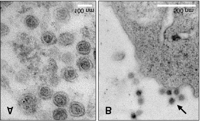 Cryotransmission electron microscopy (TEM) image