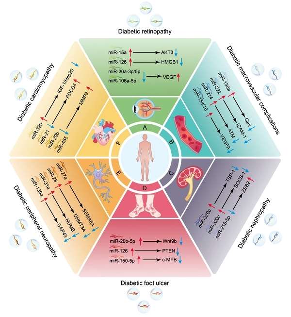 Molecular mechanisms by which exosomal miRNAs regulate the progression of DM‐associated complications