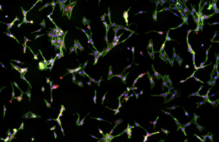 Preformed Tumor Cell Stably