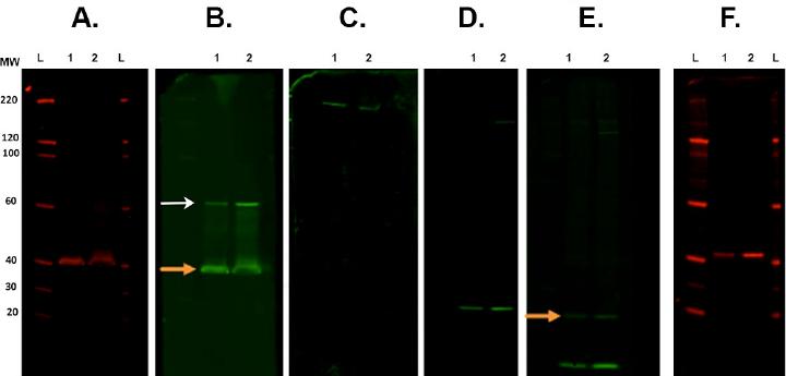 Western Blot Analysis: Stripping and Reprobing