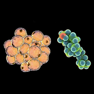 MALDI-Imaging Lipidomics