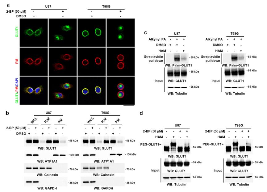 Effect of acetylation on GLUT1's membrane localization in GBM cells.