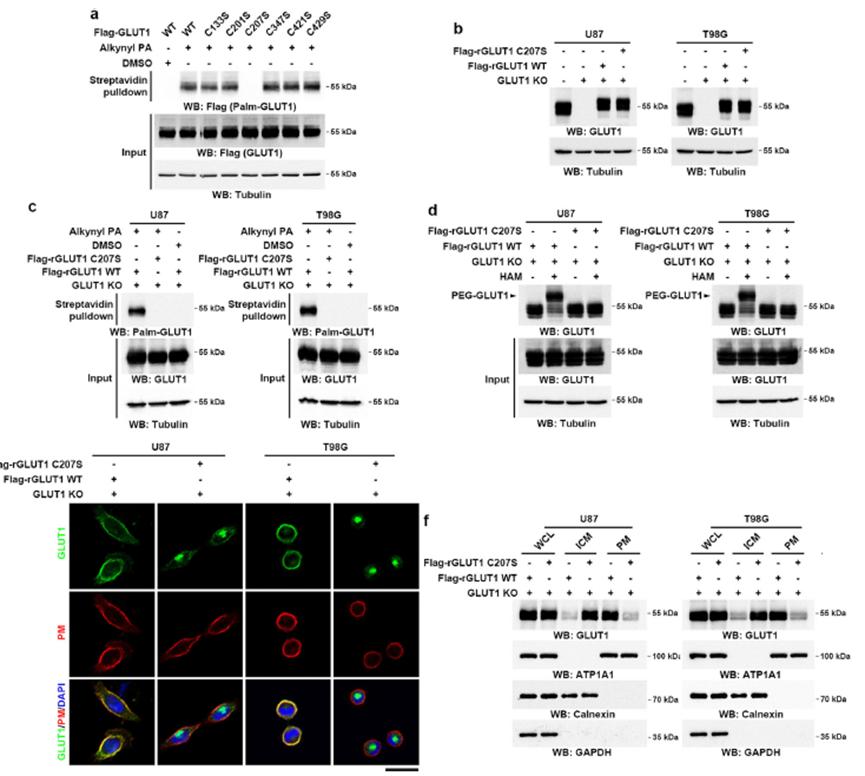 Identification of Cys207 as a palmitoylation site on GLUT1.