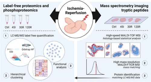 Phosphoproteome in the human intestine using liquid chromatography-tandem mass spectrometry (LC-MS/MS) analysis