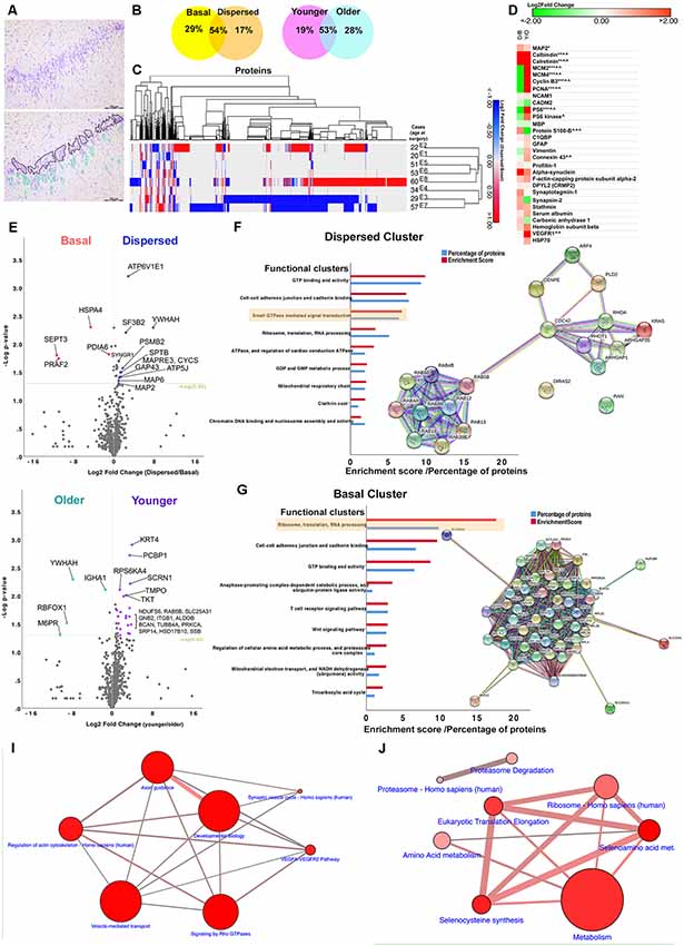 Studying Protein and Phosphorylation Changes in Epilepsy Patients Using Proteomics