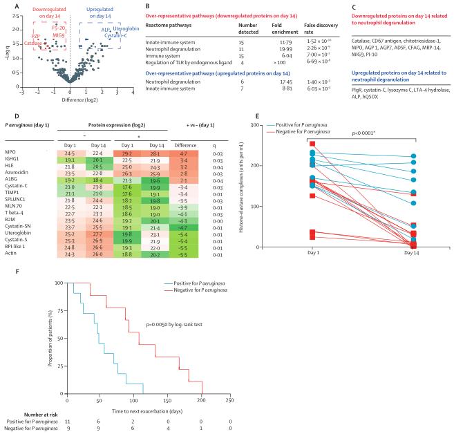 Unlocking Personalized Treatment for Bronchiectasis: Proteomics Reveals Biomarkers of Severity and Response