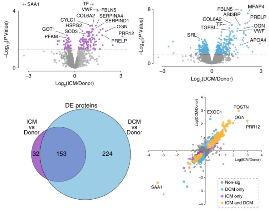 Differential protein analysis of ICM and DCM