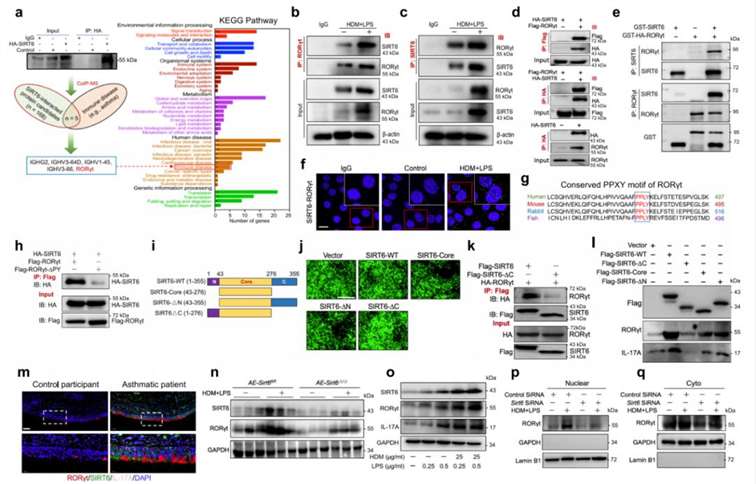 SIRT6 Directly Binds to RORγt and Regulates RORγt Expression