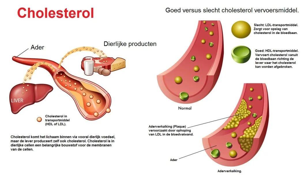 Cholestero LC-MS Analysis Service