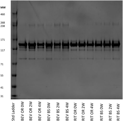 Figure 5: SDS-PAGE results