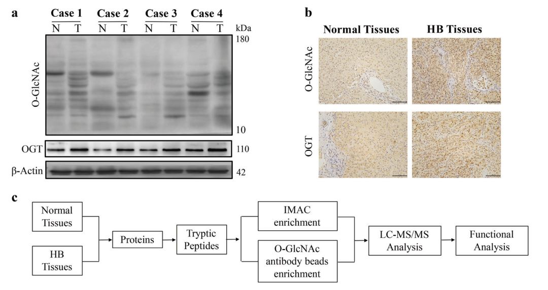 Results of WB and IHC experiments and modificationomics workflow