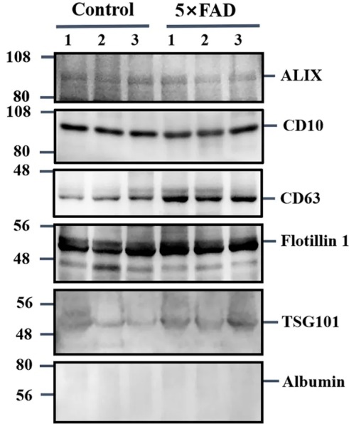 Identifying Urinary Exosomal Biomarkers for Early Alzheimers Detection