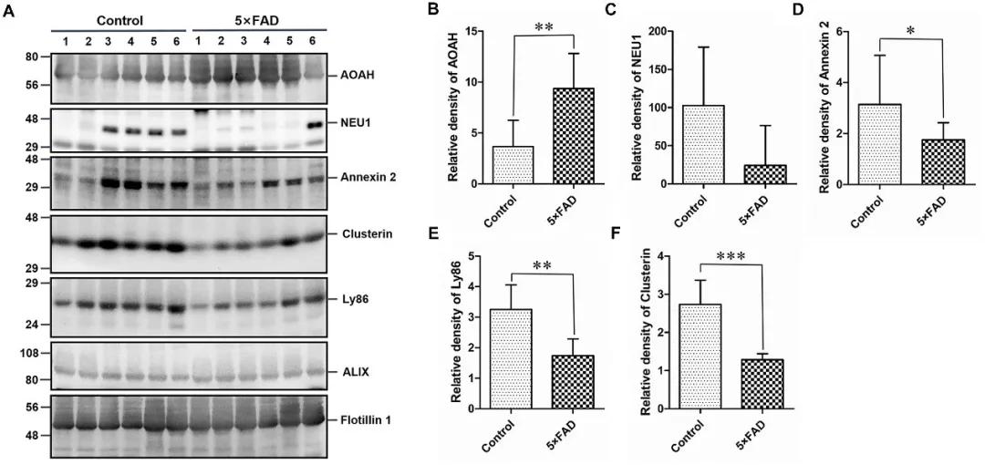 Identifying Urinary Exosomal Biomarkers for Early Alzheimers Detection