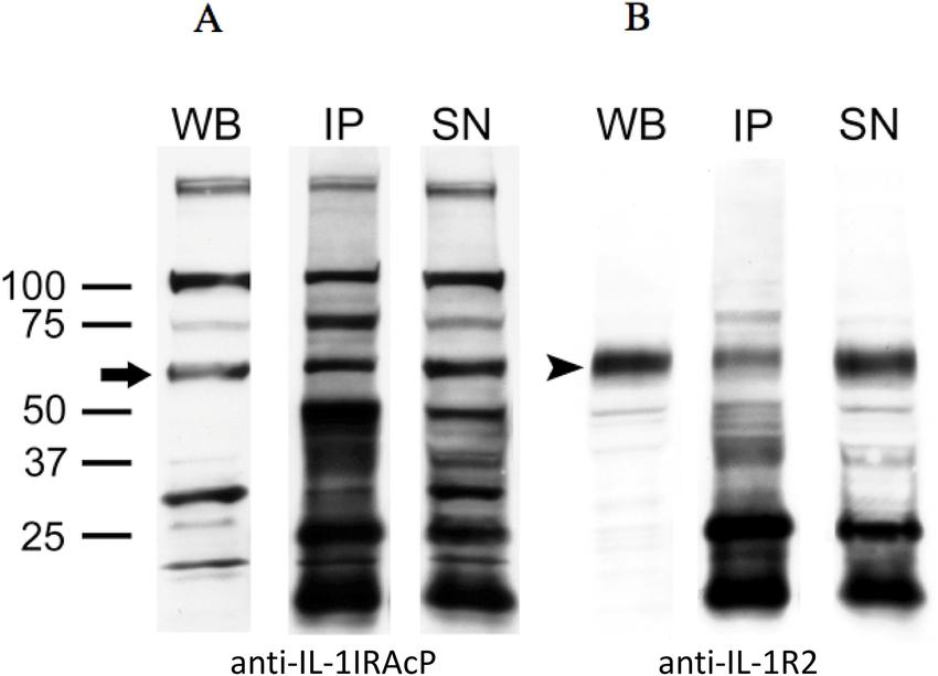 A) Western blot (WB), immunoprecipitation (IP), and supernatants (SN) of the immunoprecipitation reaction with anti-IL-1IRAcP is shown in the left panel