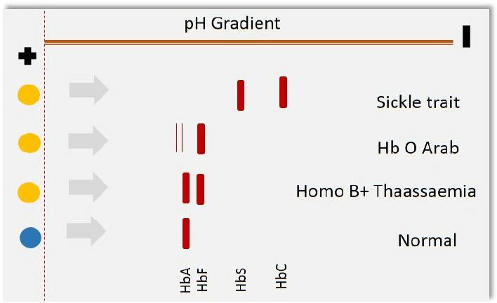 Isoelectric Focusing: Principles, Applications, Advantages, and Limitations