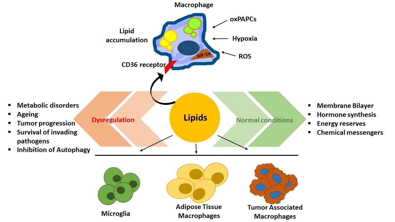 Role of Lipids in Macrophages and Associated Diseases