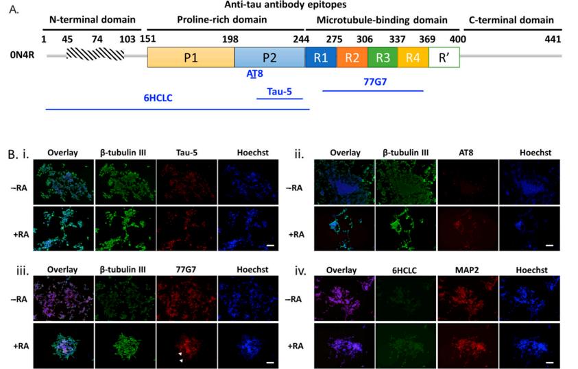 Expression of tau phospho-isoforms in SH-SY5Y cells that have been differentiated.