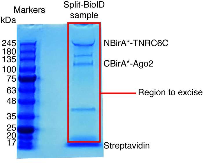 Protein Gel Staining Methods: Coomassie, Silver, Fluorescent, Zinc, and Functional Group-Specific