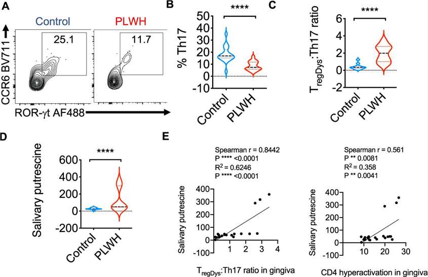 Flow cytometry analysis of gingival mucosal cells from healthy controls (n=19) and PLWH (n=30) showing Th17 proportions (A, B), TregDys/Th17 ratios (C), and salivary putrescine levels (D). Correlation plots of TregDys/Th17 ratios and CD4 hyperactivation with salivary putrescine (E). Statistical significance is indicated by P values and data are represented as median values ± SEM.