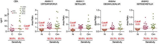 SRM and MRM Analysis Service