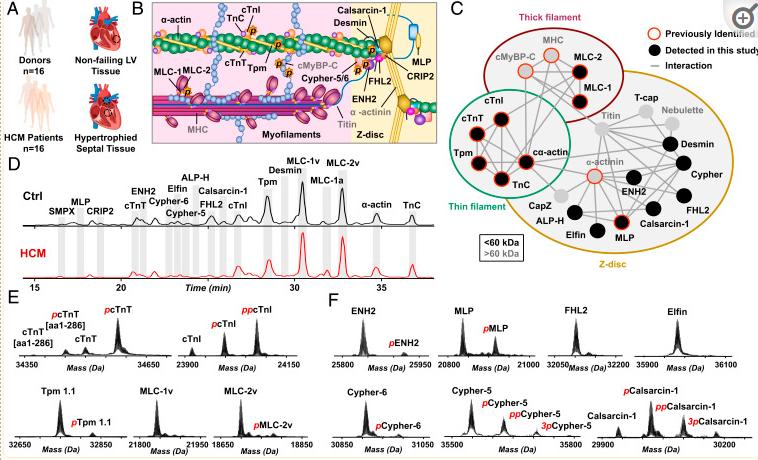 Fig. 1. A complex sarcomeric proteoform landscape.