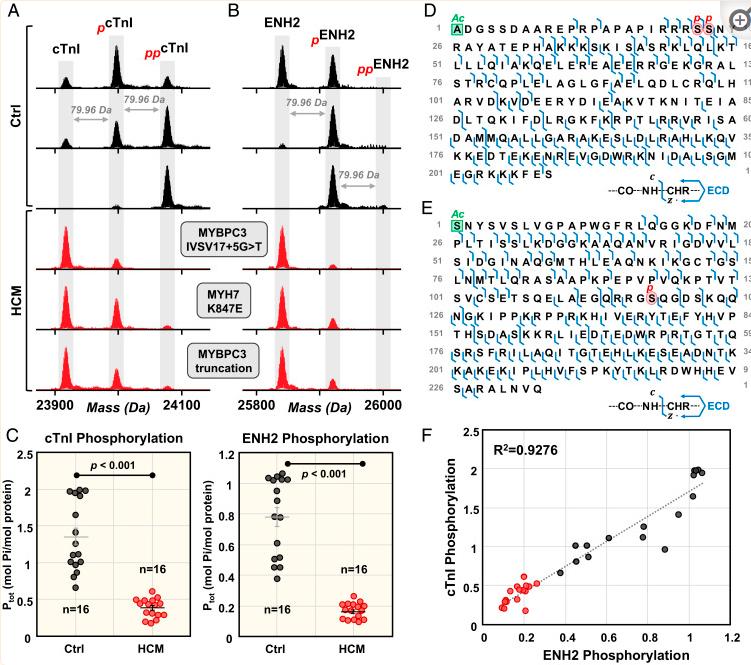 Fig. 2. Coordinated decrease in cTnI and ENH2 phosphorylation in HCM tissues