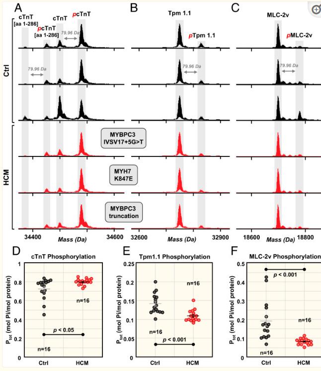 Fig. 3. Altered phosphorylation of cTnT, Tpm1.1, and MLC-2v.