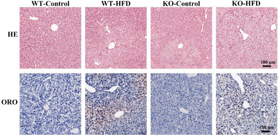 Figure 4: Lipid Deposition in the Liver