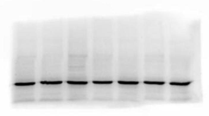 Western Blot Detection Service